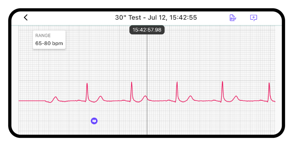 CARDINOVA ECG – 歷史紀錄