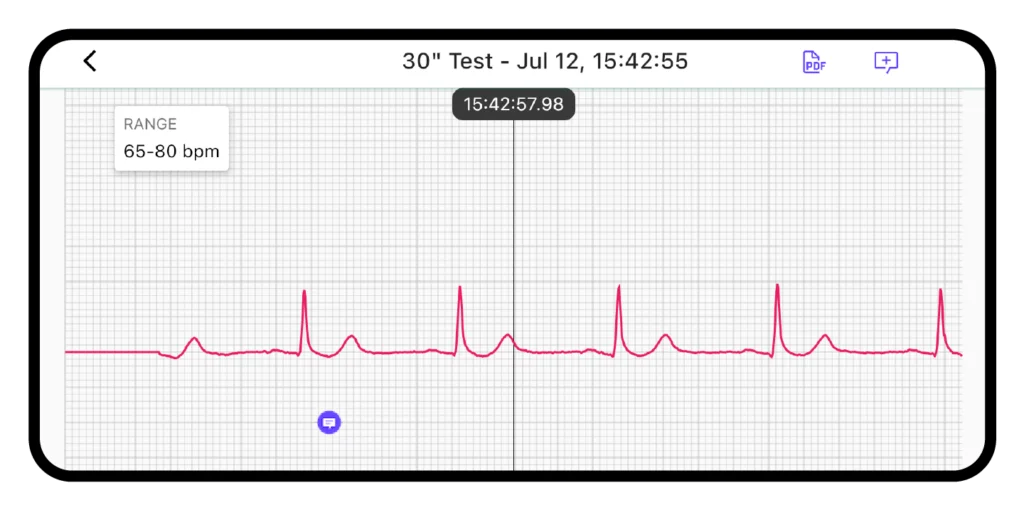 CARDINOVA ECG – 歷史紀錄