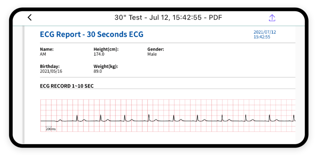 CARDINOVA ECG – 方便快速PDF報告