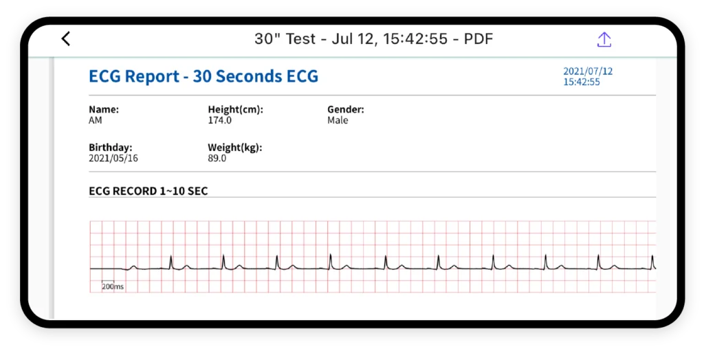 CARDINOVA ECG – 方便快速PDF報告