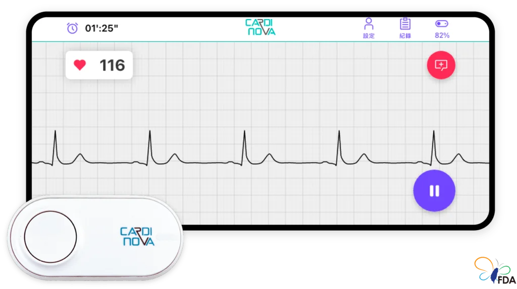 CARDINOVA ECG – ECG Sensor and Cardinova App
