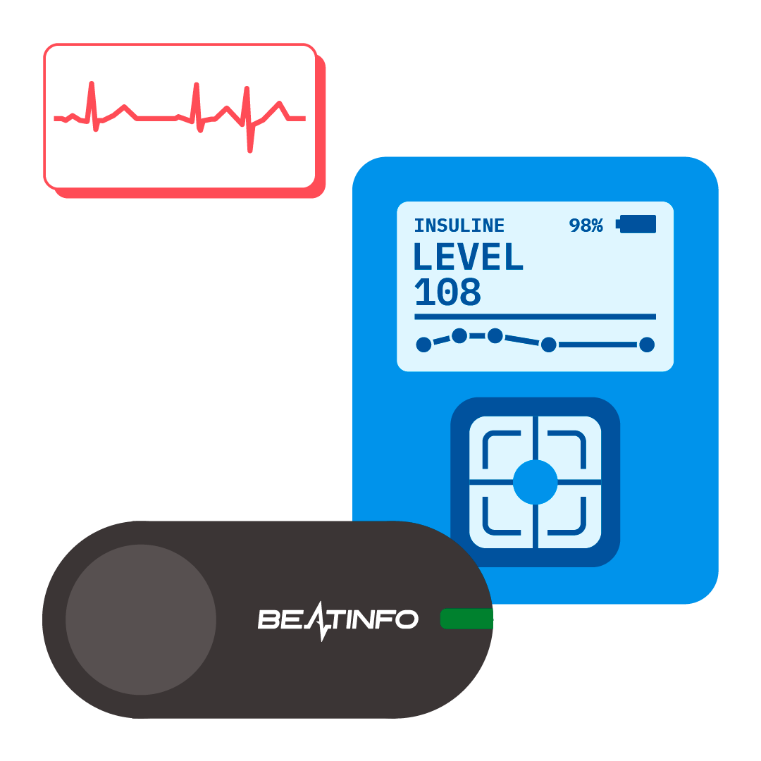 Irregular Ecg Causes